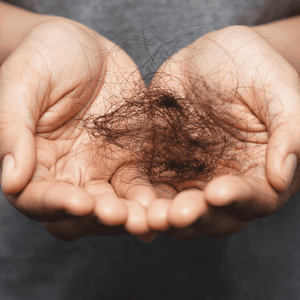 Hair Loss Information